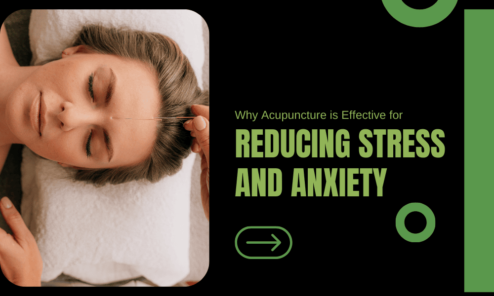 A woman with a needle in her forehead, receiving acupuncture for stress and anxiety at M City Holistic Therapy, promoting relaxation and well-being.